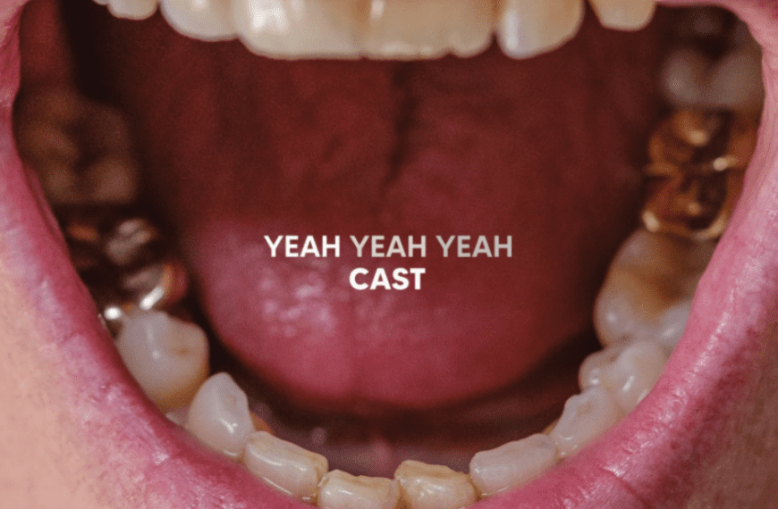 Yeah Yeah Yeah Review – Cast – Album Review
